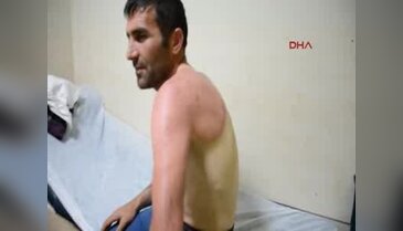 Güneş acemi çiftçiyi yaktı