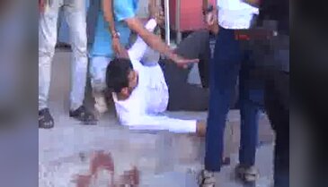 Şanlıurfa'da akraba aileler arasında kavga 1 ölü, 4 yaralı