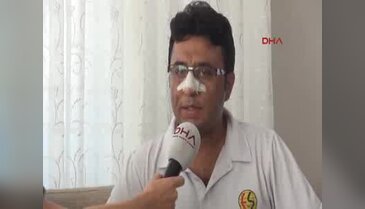 Sendika başkanına 'Burun kırma' suçlaması