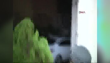 Restoranda çocuğa asitli madde atıldı