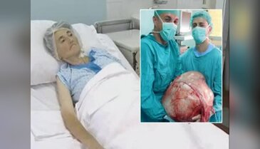 52 yaşındaki kadının karnından 30 kiloluk tümör çıktı