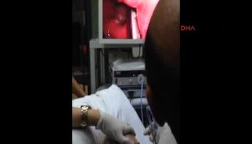 Uyurken boğazına diş protezi kaçtı