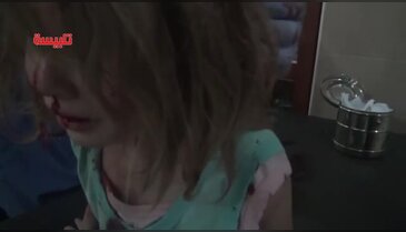 Suriyeli çocuğun yürek yakan dramı