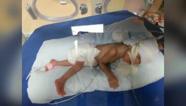 Özlem 10 ayda 850 gramdan 8 kilo 700 grama ulaştı