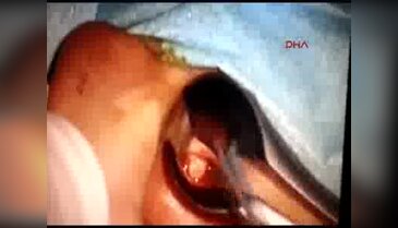 Kulağından 16 larva çıktı