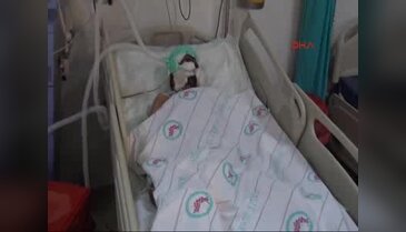 Patlamada kafasına saplanan taş ameliyatla çıkartıldı