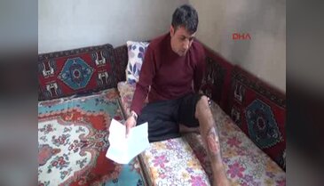 Bacağındaki yara 9 yıldır iyileşmiyor