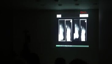 Türk doktor Almanya'nın saygın hastanelerinden St.Theresien'de bölüm başkanı oldu