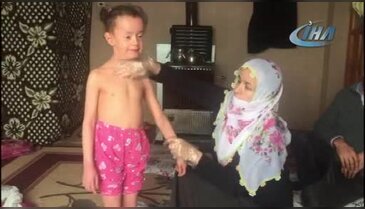 Küçük Aslı tedavi için yardım bekliyor