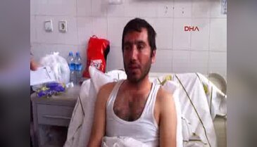 Alında bot izi çıkartan polis dayağına Yargıtay ayarı: İşkence olabilir