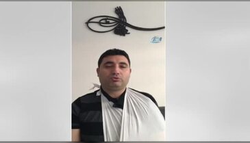 Hollanda polisinin köpekli saldırısında yaralanan Türk konuştu