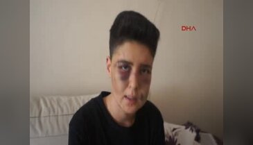 Cinsiyet değiştirmeye çalışan gençten parkta dayak iddiası