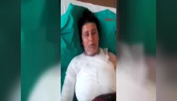 Bursa'da kocasının sevgilisi tarafından üzerine sıcak su döküldü