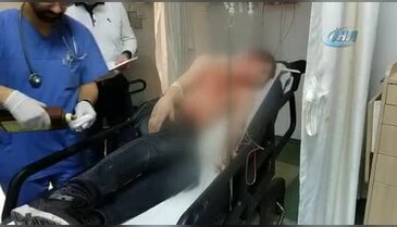 Travestinin usturalı saldırısına uğrayan genç ölümden döndü!