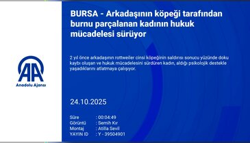 Köpeğin saldırdığı kadının mücadelesi sürüyor