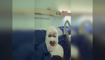 Kıskançlık krizi gözünü kararttı! Kadını üzerine döktüğü madde ile yaktı...