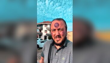Meşhur uygulama yüzünü bu hale getirdi! Yine de savundu...