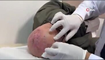 Dünyada sadece iki örneği vardı, üçüncüsü Türkiye'de çıktı! Ceviz büyüklüğünde...