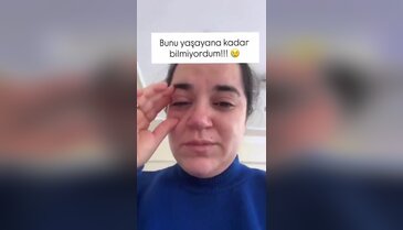 Bulaşık makinesi tableti gözünde patladı, neredeyse kör oluyordu! Ev hanımlarını uyardı...